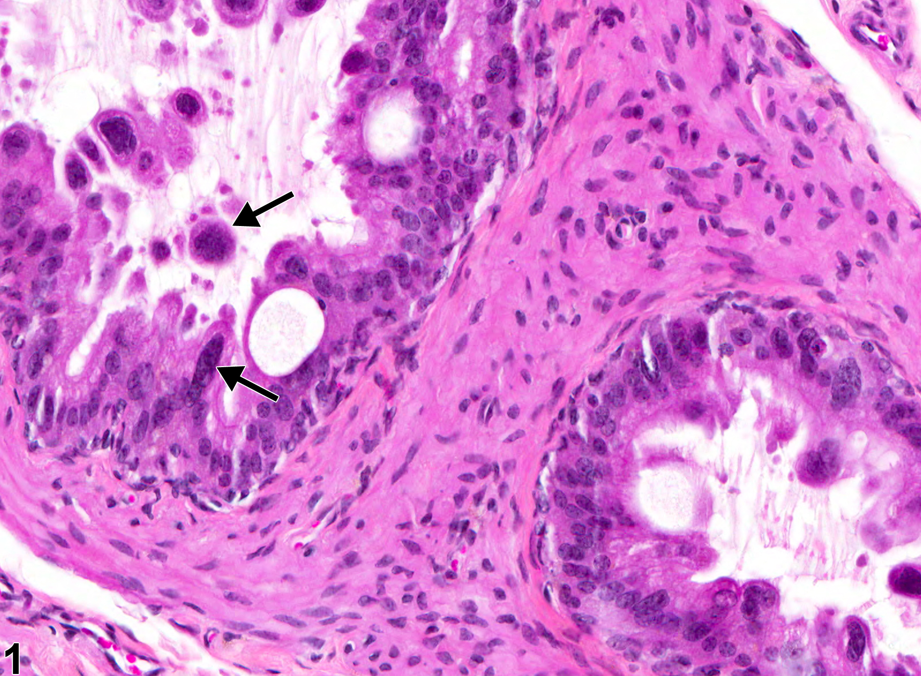 Image of epithelial karyomegaly in the epididymis from a male B6C3F1 mouse in a chronic study