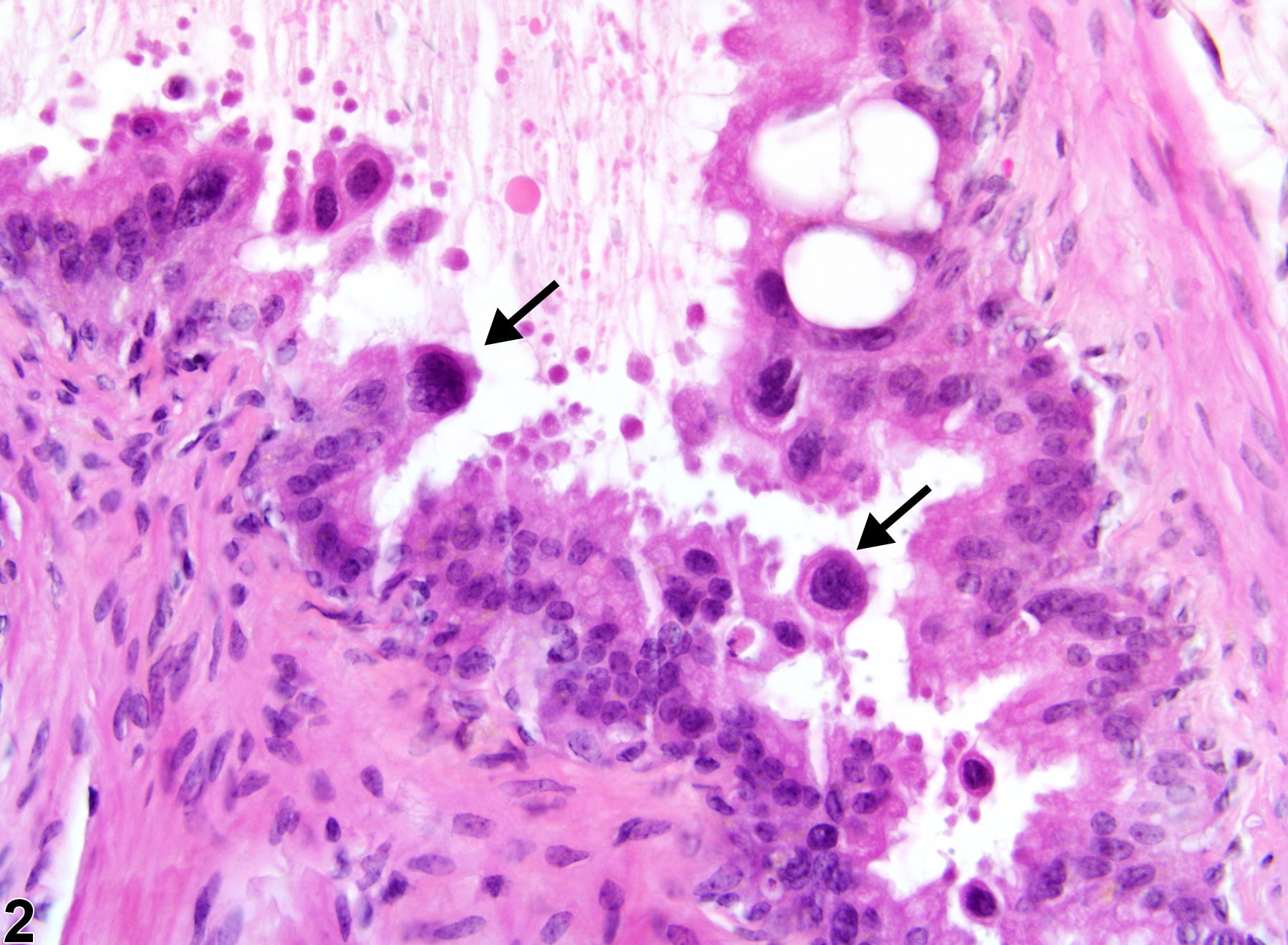 Image of epithelial karyomegaly in the epididymis from a male B6C3F1 mouse in a chronic study