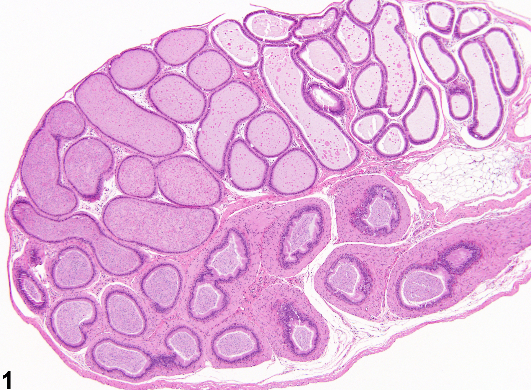 Image of hypospermia in the epididymis from a male B6C3F1 mouse in a subchronic study