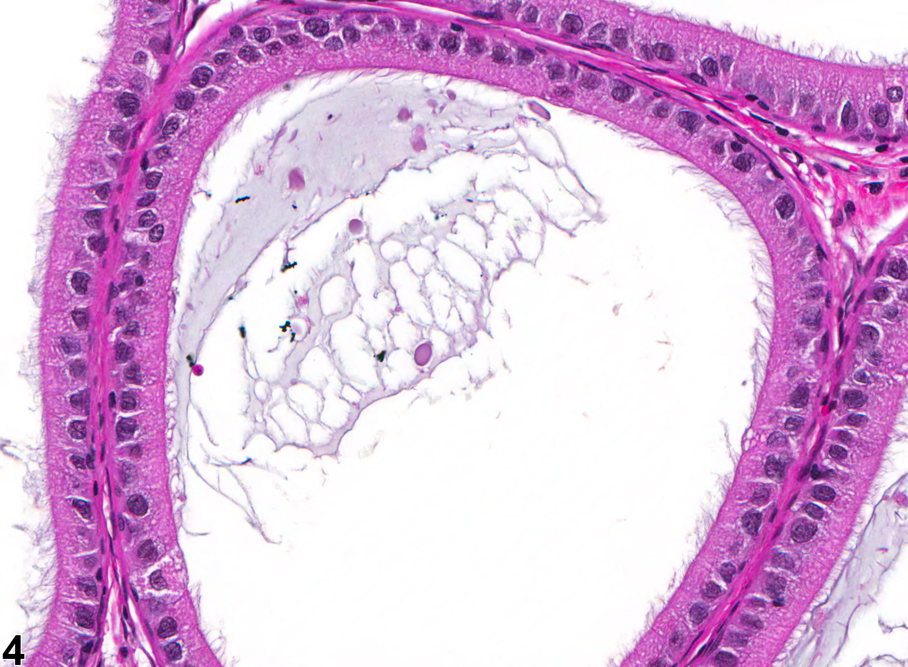 Image of hypospermia in the epididymis from a male F344/N rat in a subchronic study