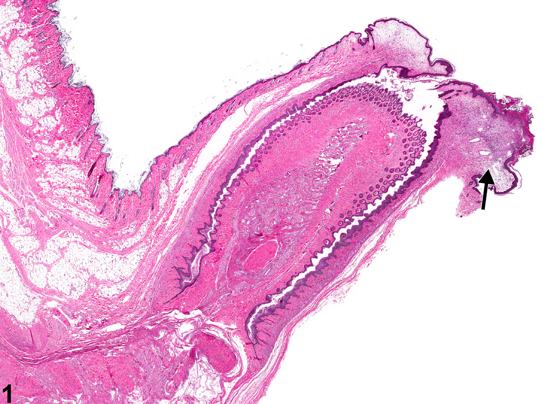 Image of prepuce inflammation in the penis from a male F344/N rat in a chronic study