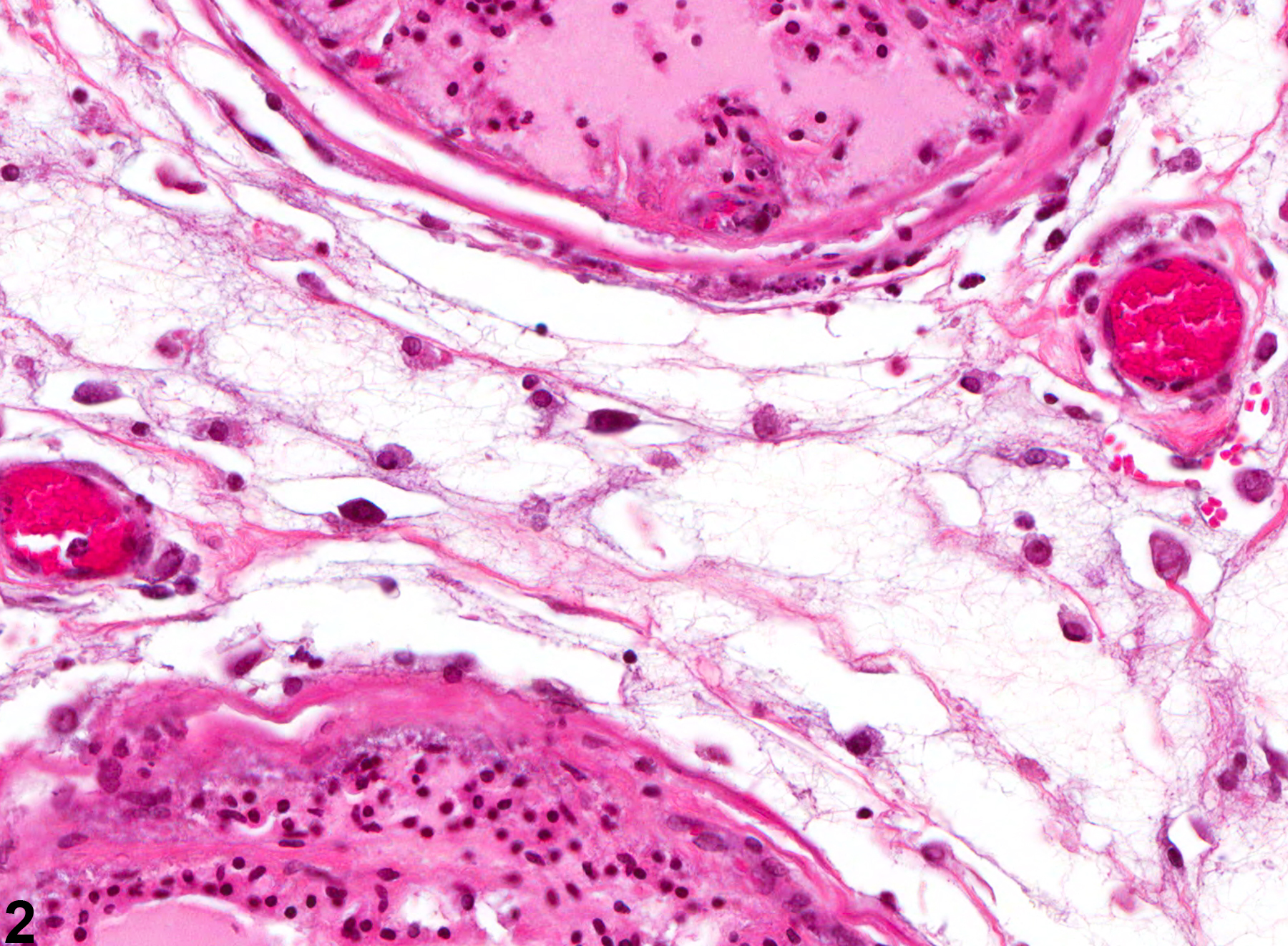 Image of edema in the prostate from a male F344/N rat in a chronic study