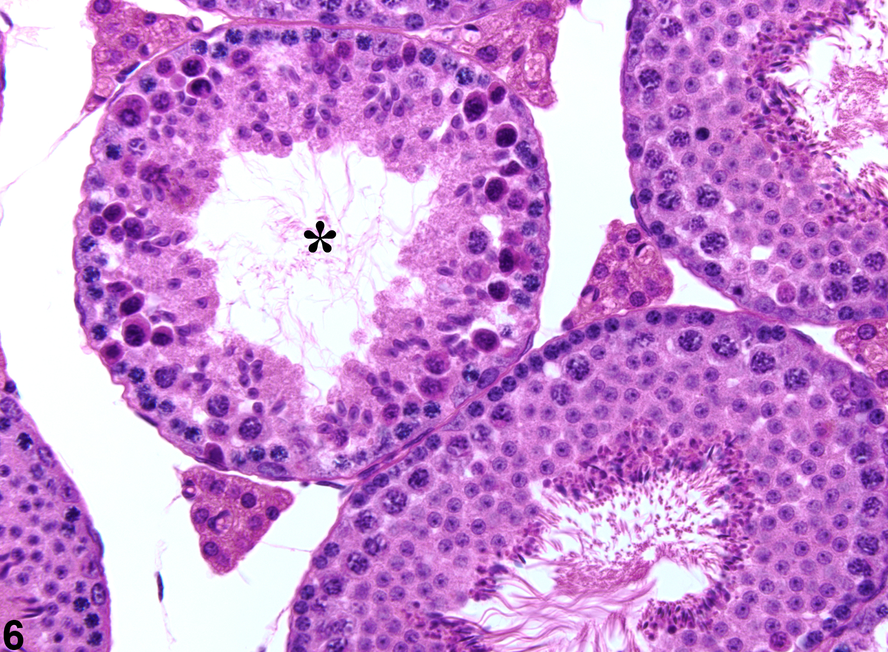 Image of germinal epithelium degeneration in the testis from a male BALB/c mouse in a 12-hour exposure study