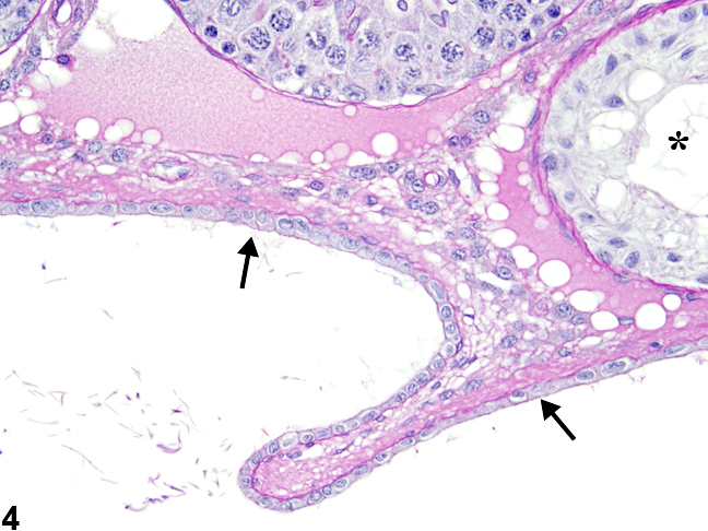 Image of normal rete testis in the testis from a male Harlan Sprague-Dawley rat in a multigenerational reproduction study