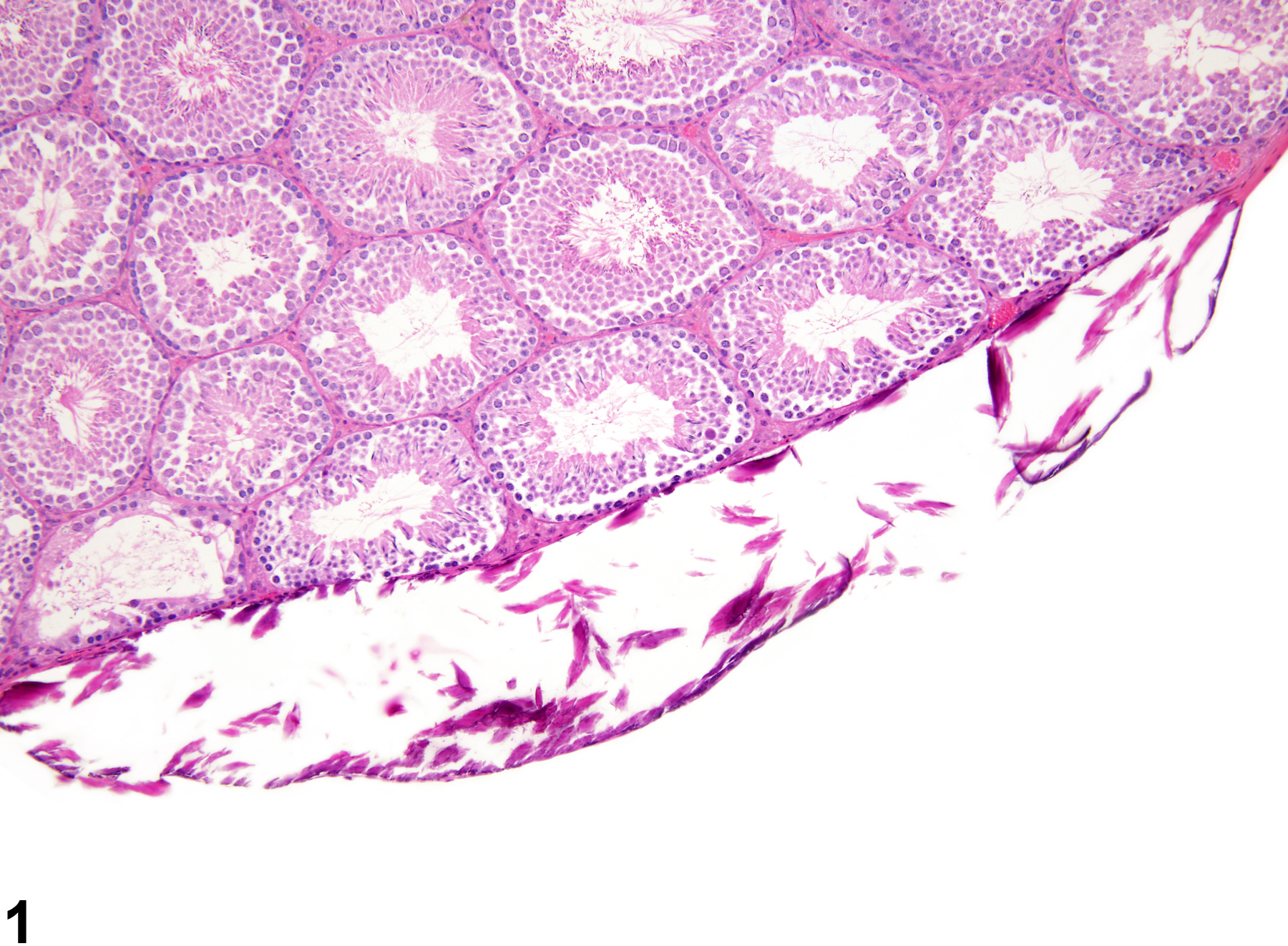 Image of mineralization in the testis from a male B6C3F1 mouse in a chronic study