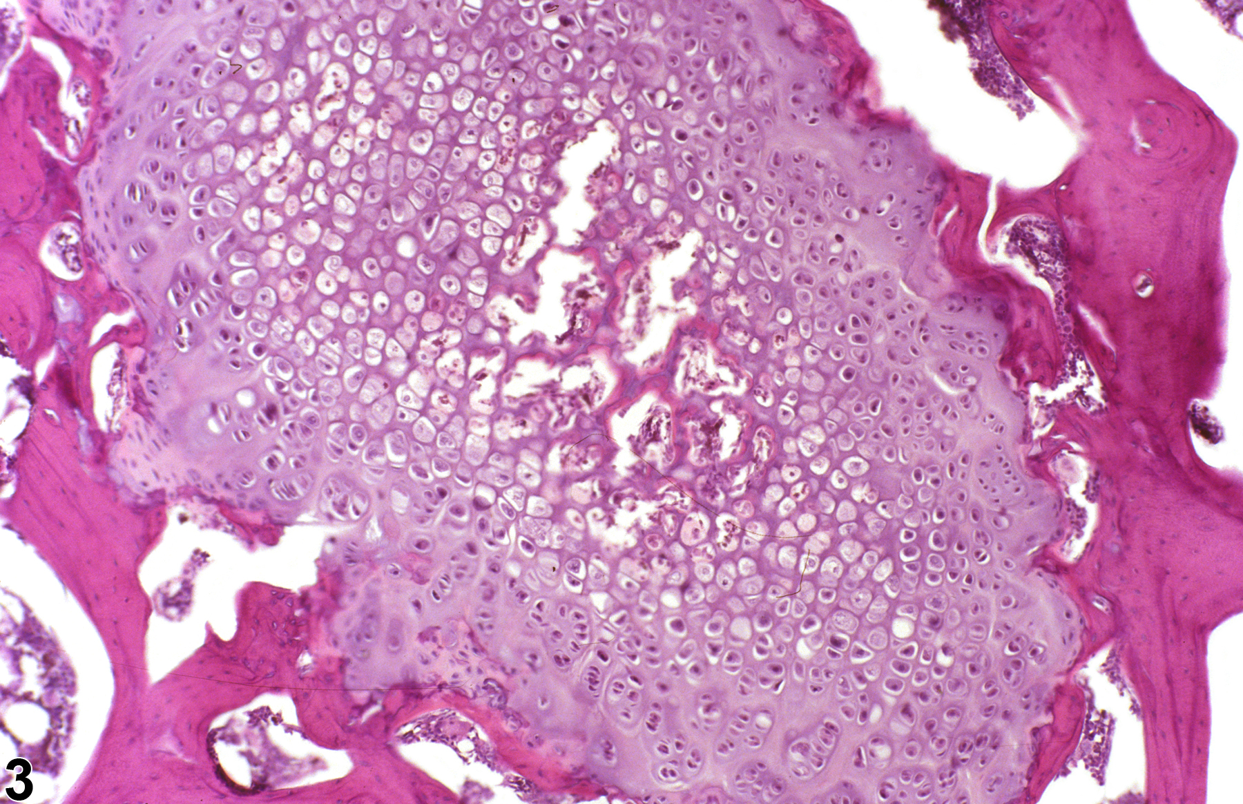 Image of physeal dysplasia in the bone from a male F344/N rat in a subchronic study