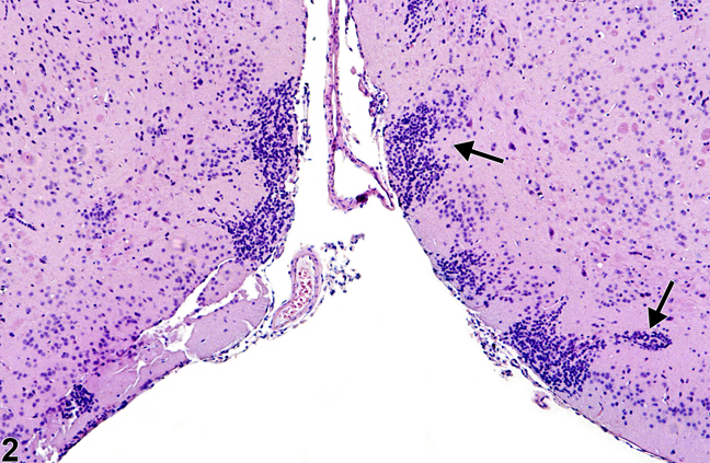 Image of normal islets of Calleja in the brain from a male B6C3F1 mouse in a chronic study