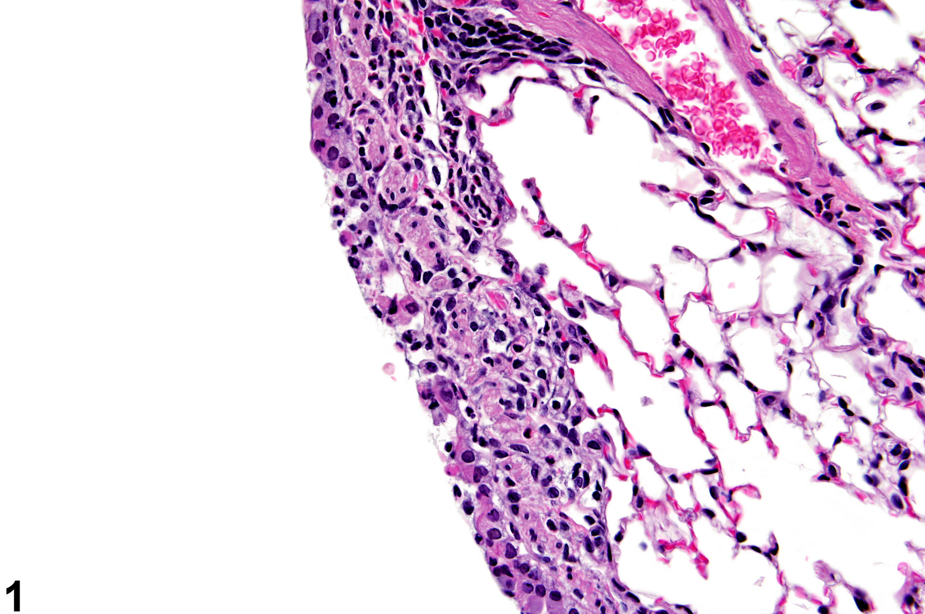 Image of epithelial necrosis in the lung from a male B6C3F1/N mouse in a subchronic study