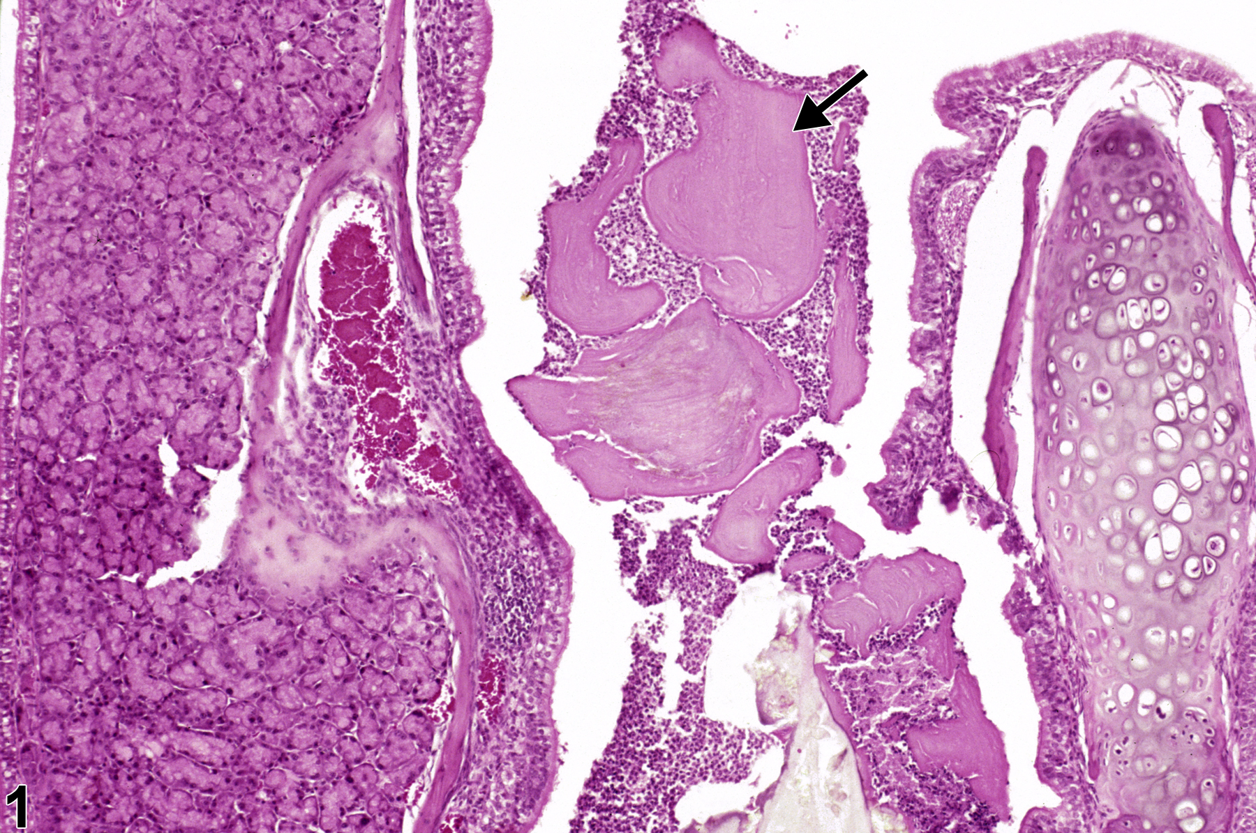 Image of concretion in the nose from a male B6C3F1/N mouse in a chronic study