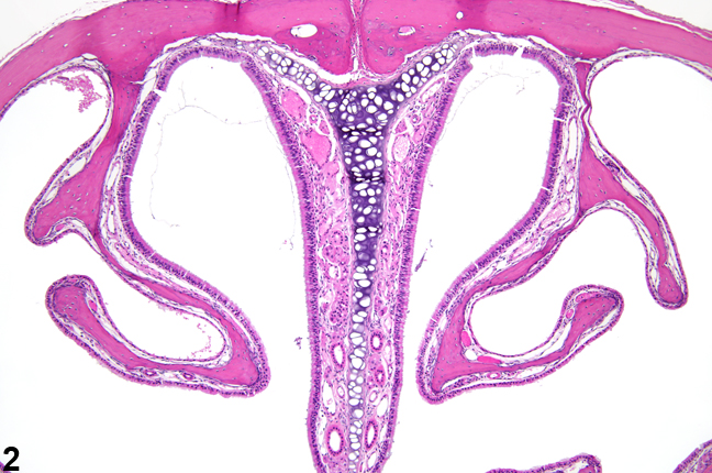 Image of normal dorsal meatus (level I) in the nose from a male B6C3F1/N mouse in a subchronic study