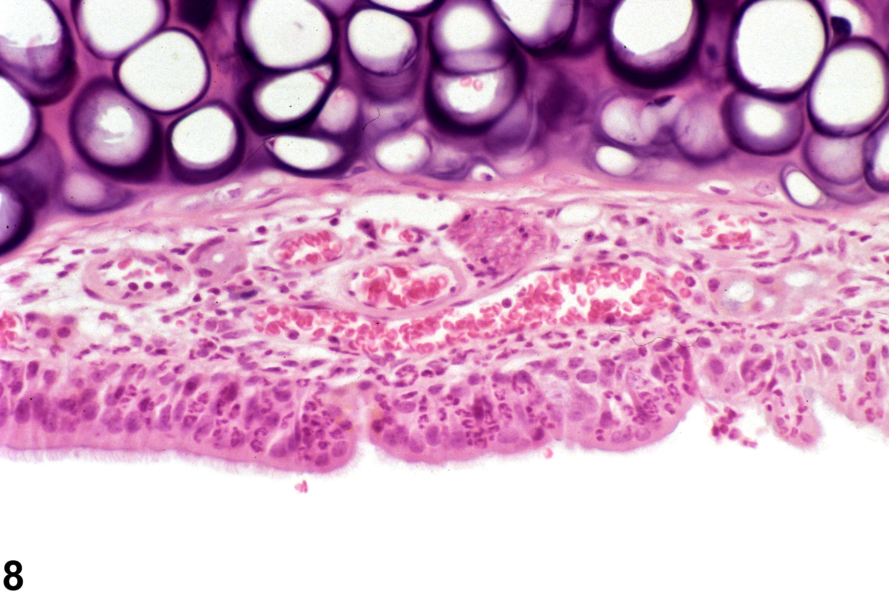 Image of inflammation in the nose, respiratory epithelium from a male B6C3F1/N mouse in a chronic study