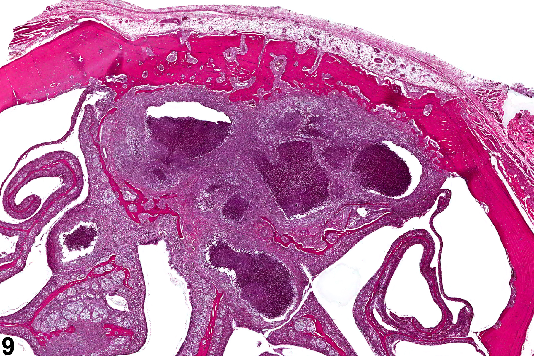 Image of inflammation in the nose, olfactory epithelium from a male F344/N rat in a chronic study