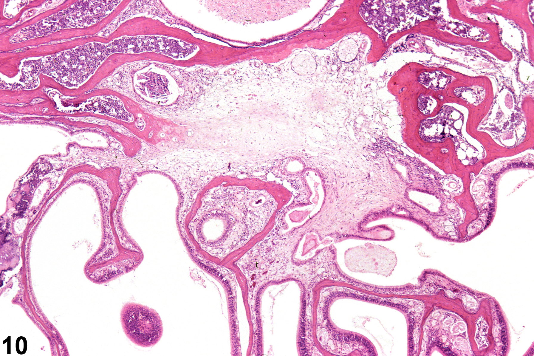 Image of inflammation in the nose, olfactory epithelium from a male B6C3F1/N mouse in a chronic study