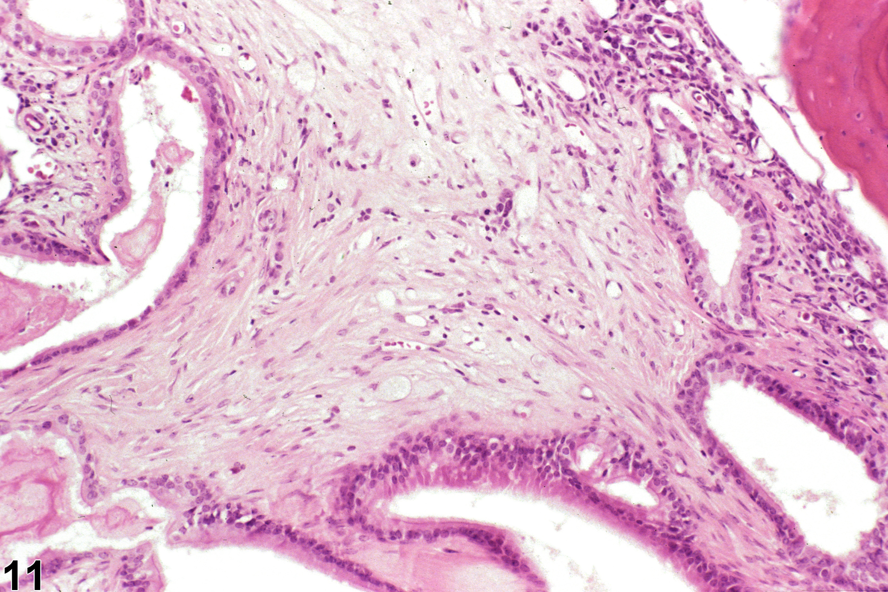 Image of inflammation in the nose, olfactory epithelium from a male B6C3F1/N mouse in a chronic study