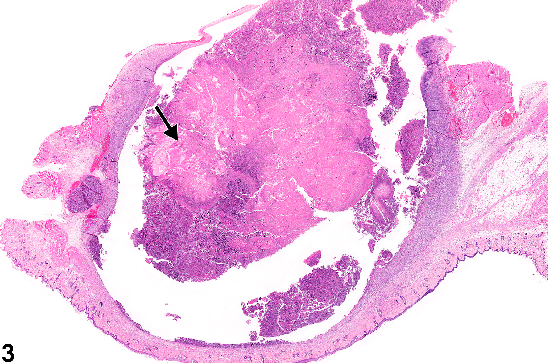 Image of inflammation in the ear from a male F344/N rat in a chronic study