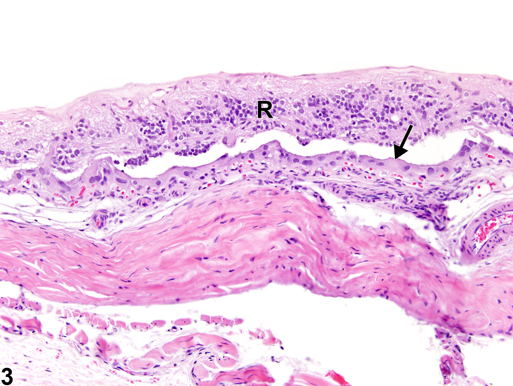 Image of retina detachment in the eye from a female F344/N rat in a chronic study