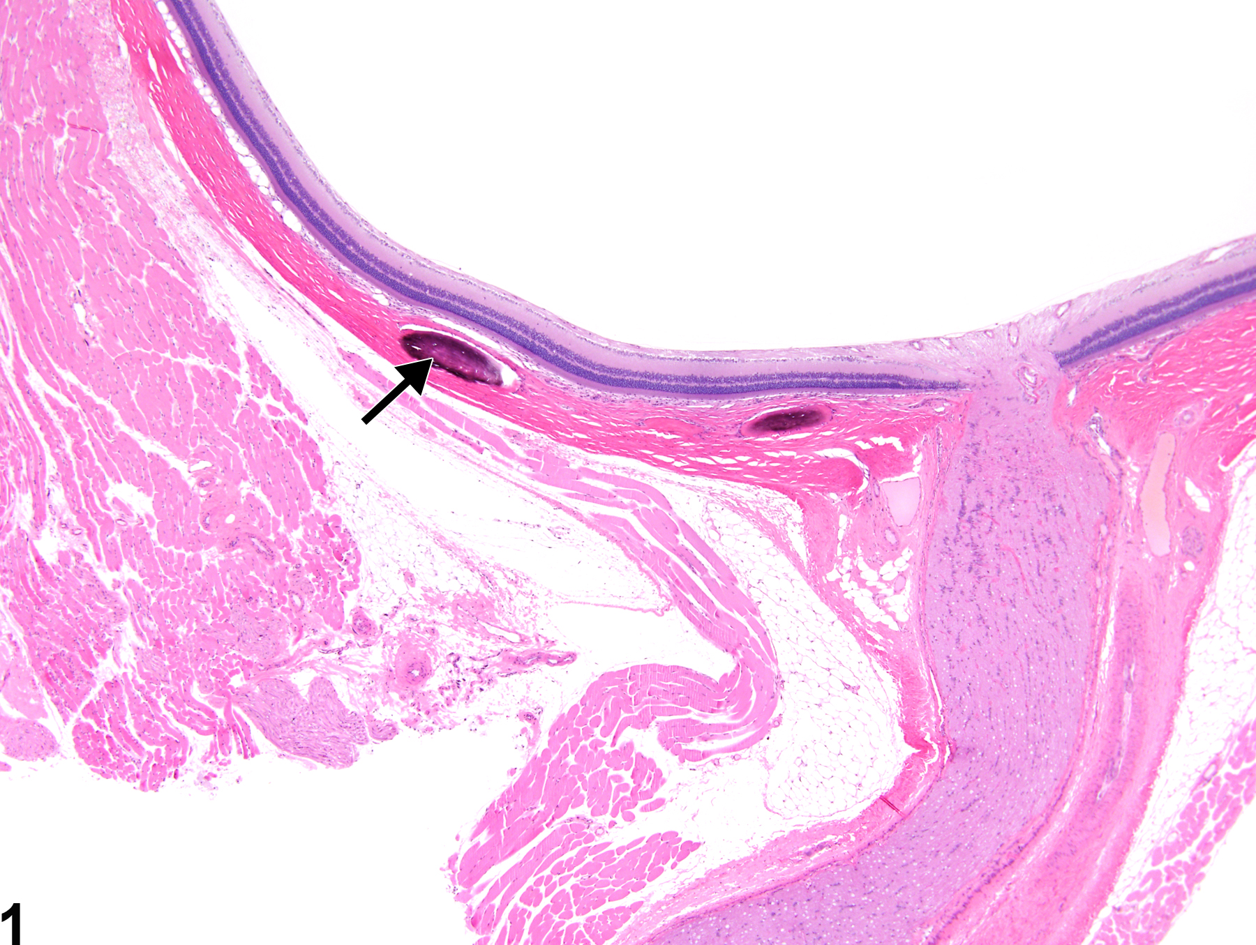 Image of sclera metaplasia, osseous in the eye from a male F344/N rat in a chronic study