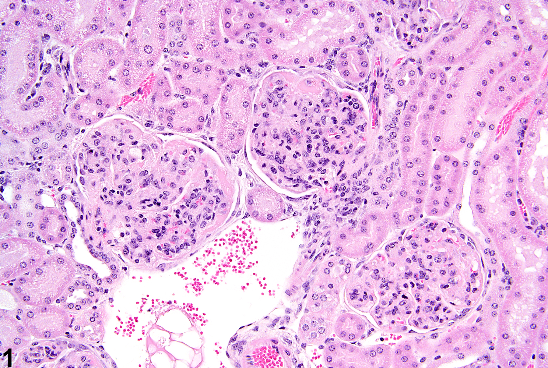 Image of glomerulonephritis in the kidney from a female B6C3F1 mouse in a chronic study