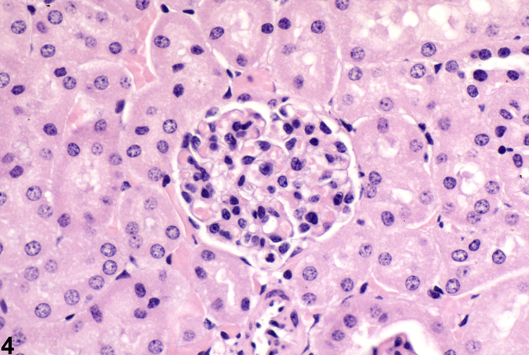 Image of glomerulonephritis in the kidney from a female B6C3F1 mouse in a subchronic study