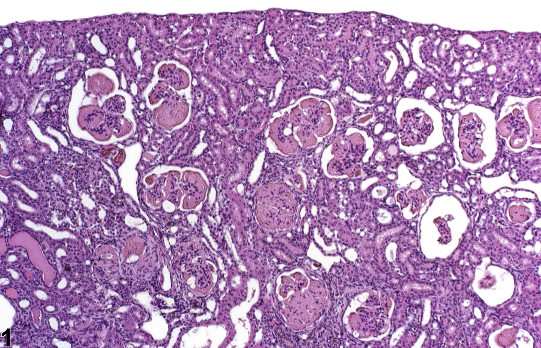 Image of hyaline glomerulopathy in the kidney from a female B6C3F1 mouse in a chronic study