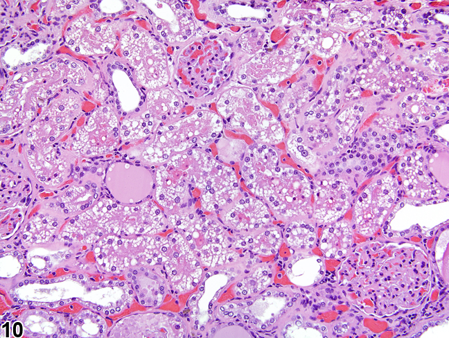 Image of autolytic vacuolation in the kidney