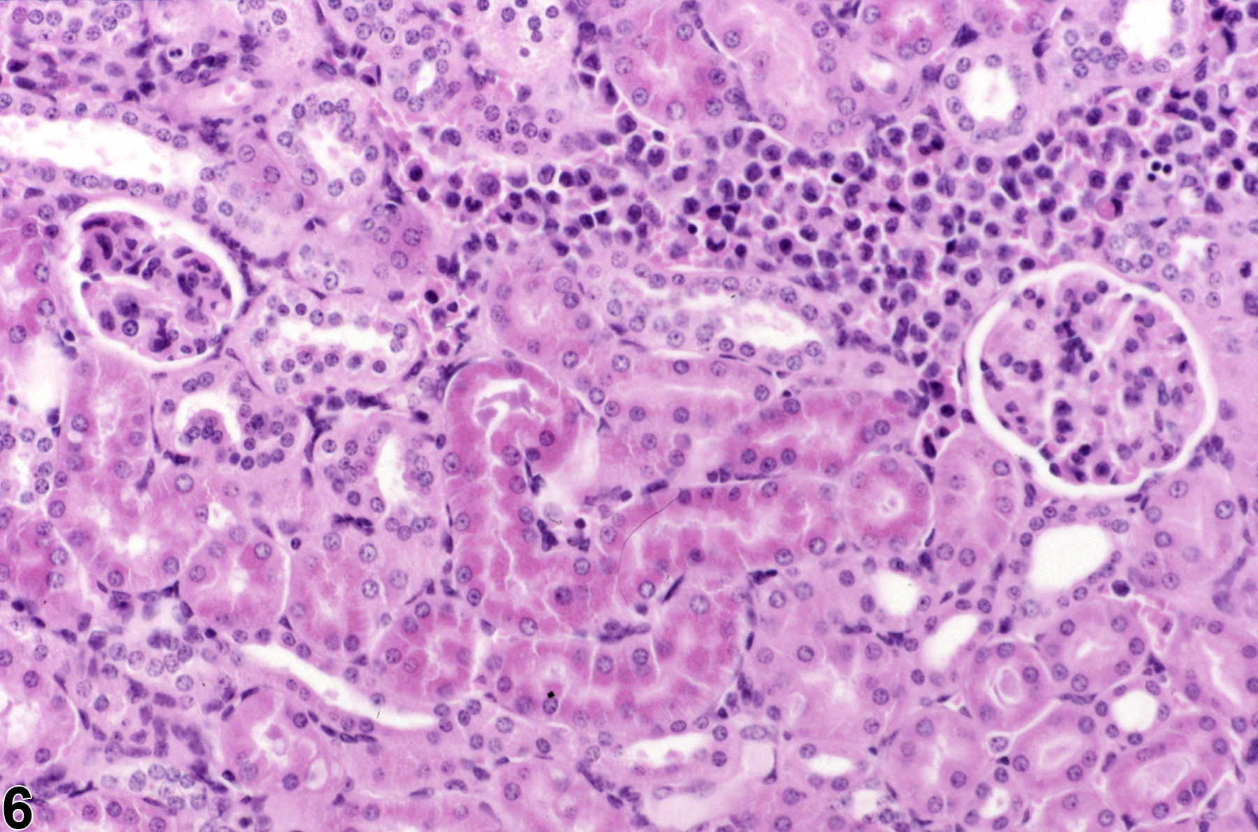 Image of renal tubule accumulation hyaline droplet in the kidney from a male B6C3F1 mouse in a subchronic study