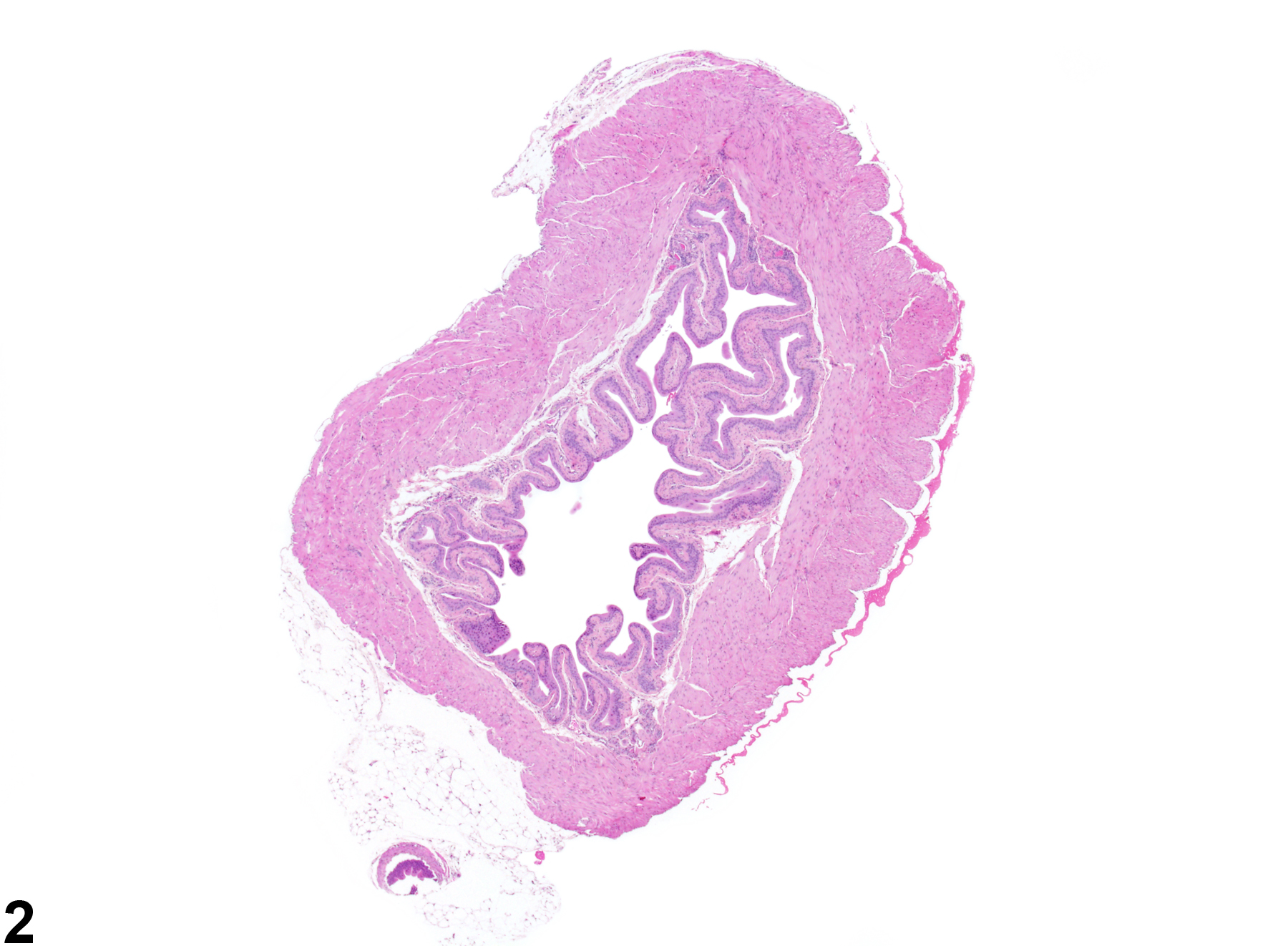 Image of dilation (normal comparison) in the urinary bladder from a male B6C3F1 mouse in a subchronic study