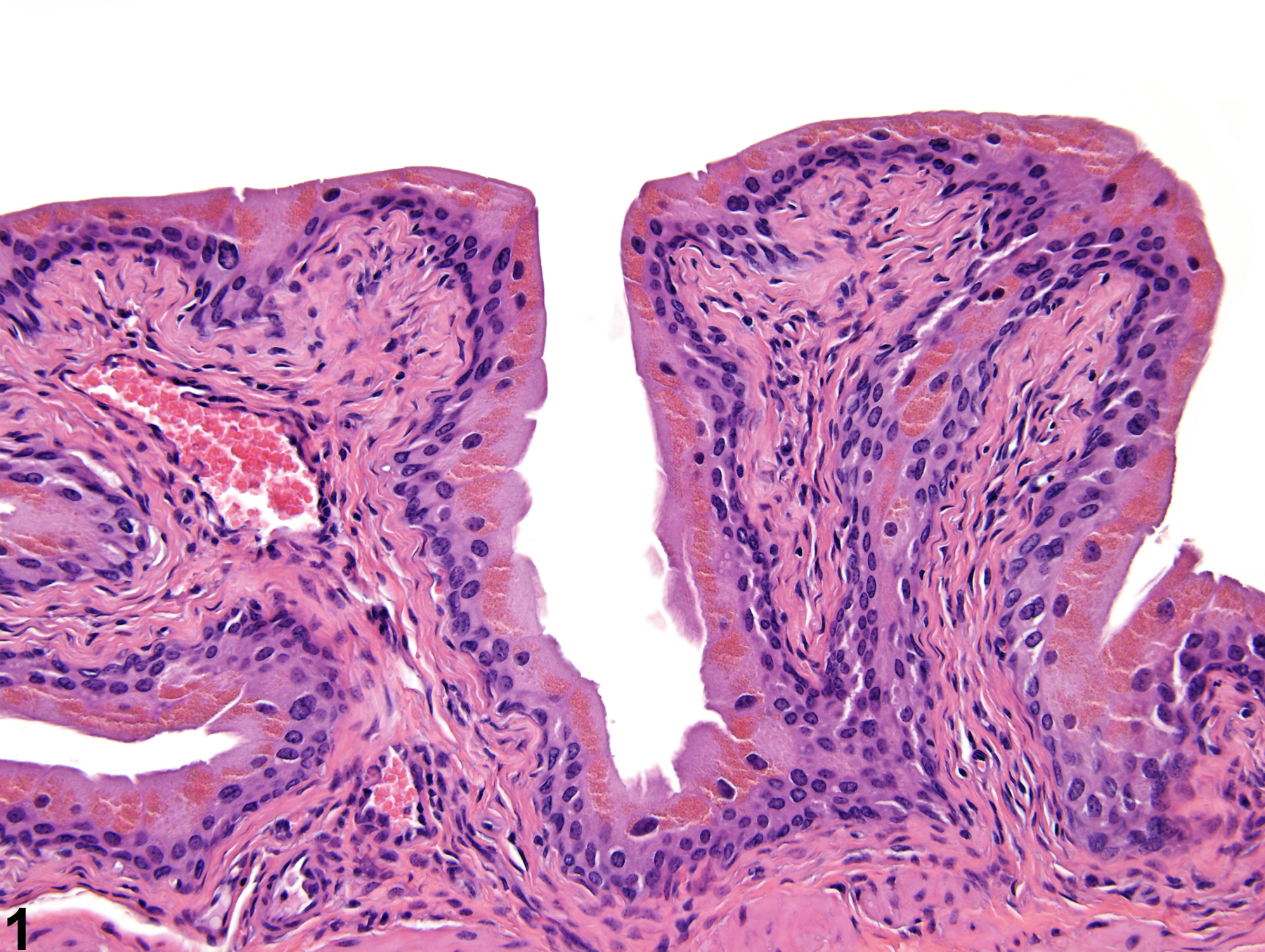 Image of cytoplasmic granules in the urinary bladder from a male B6C3F1 mouse in a subchronic study